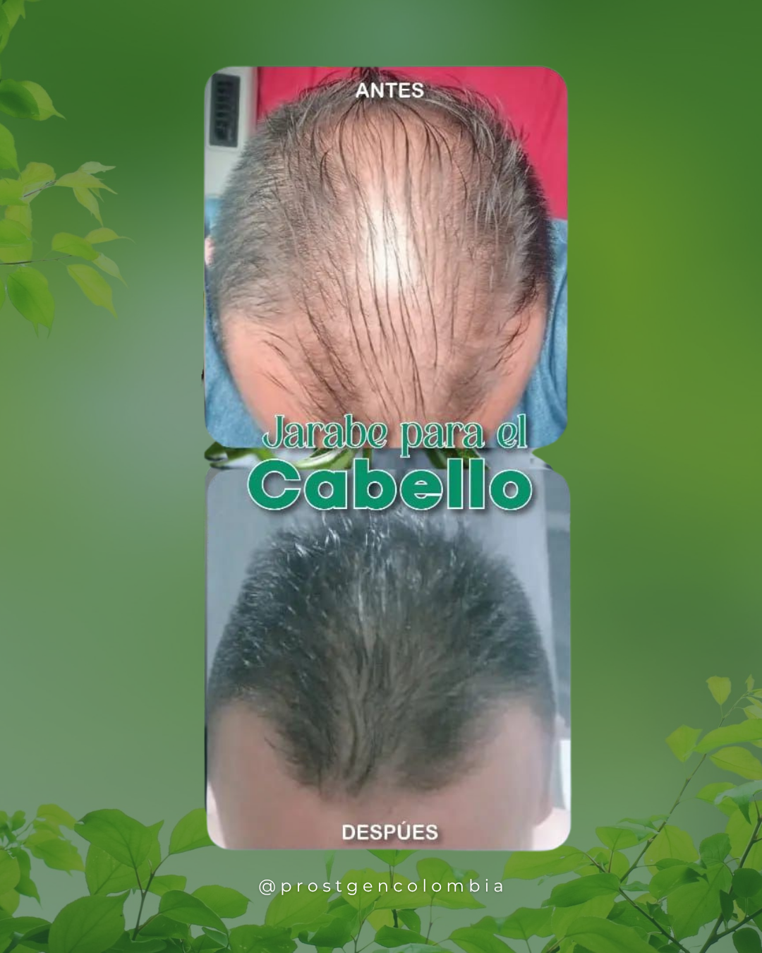 antes-despues-1