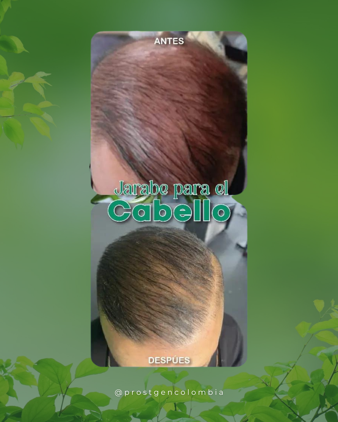 caida de cabello