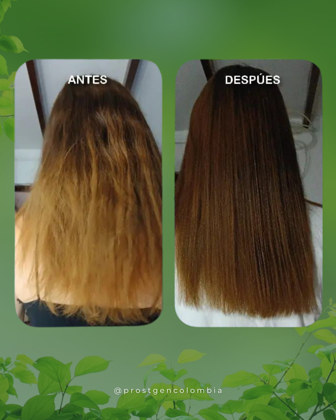perfil-prostgen-(8)